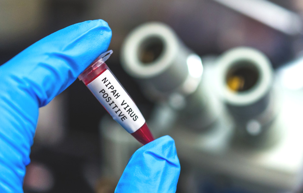 Asien verschärft Kontrollen nach Nipah-Infektionen in Indien