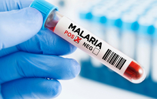 Malaria-Fälle rund um Frankfurter Flughafen steigen auf acht