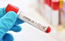 ETI übernimmt Kosten für PCR-Tests